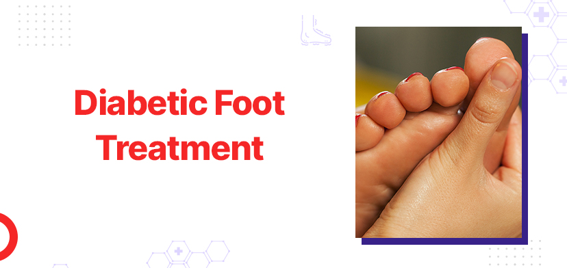 Diabetic Foot Treatment - Symptoms, Cost, and Care - Gmoney.in