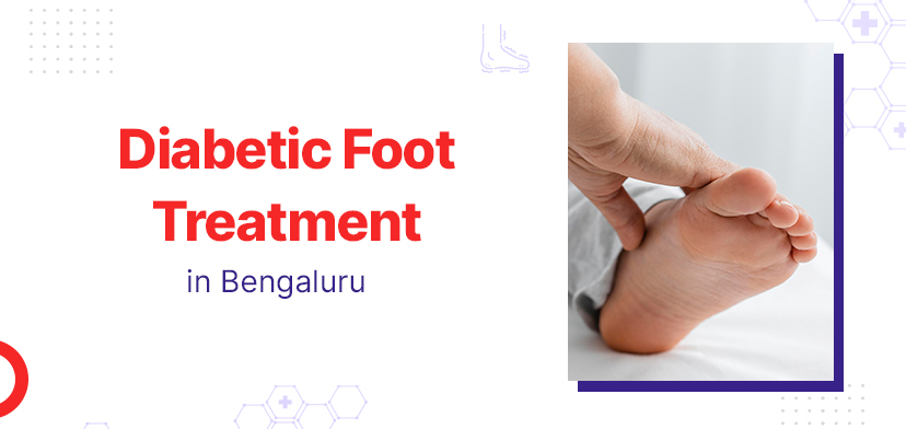 Diabetic Foot Treatment: What to Expect in Bengaluru - Gmoney.in